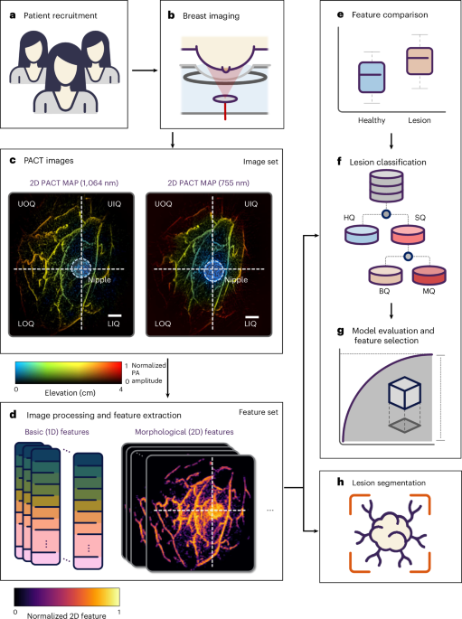 Panoramic photoacoustic computed tomography with learning-based classification enhances breast lesion characterization