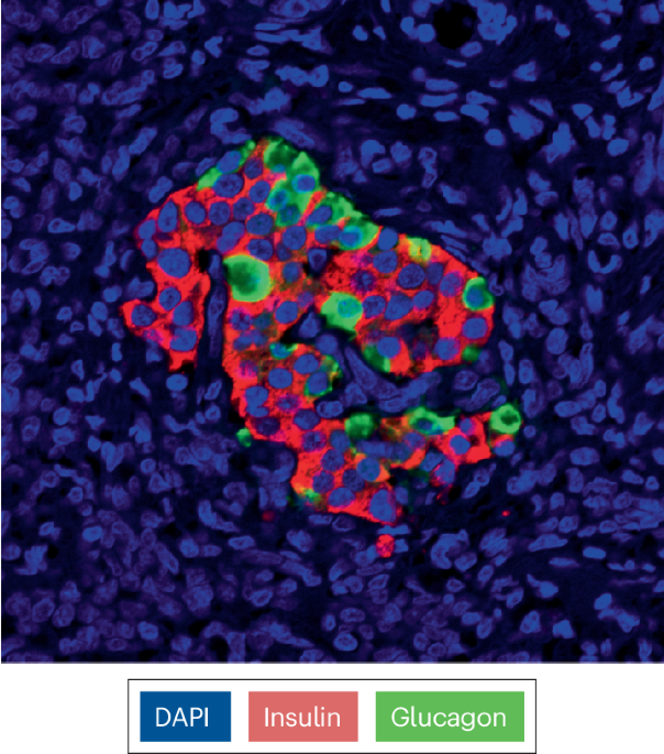 Nanoparticles help the spleen support pancreatic islet transplants