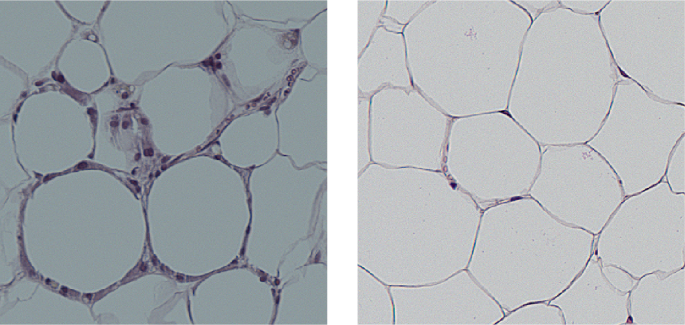 Unpicking the effects of FGF21 on longevity