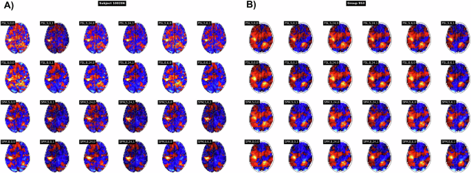 HCP Multi-Pipeline: a derived dataset to investigate analytical variability in fMRI