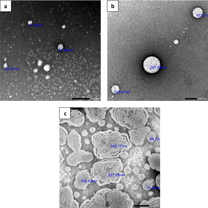 Comparative evaluation of nano ocular delivery systems loaded pH and thermosensitive in situ gels for Acanthamoeba keratitis treatment