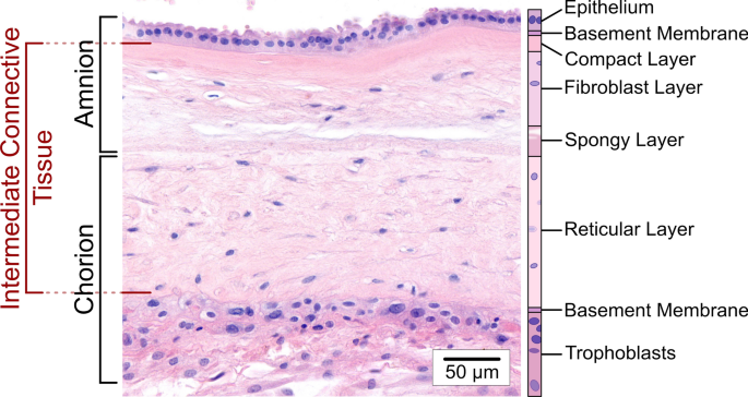 Birth mode is associated with layer-specific mechanical changes in fetal membranes