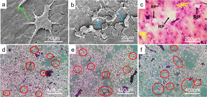 Bone, dentin and cementum differentially influence the differentiation of osteoclast-like cells