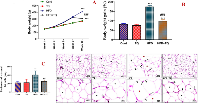 Thymoquinone controlled obesity and invigorated cognitive and memory performance in rats consuming a high-fat diet via modulating oxidative stress, inflammation and apoptosis