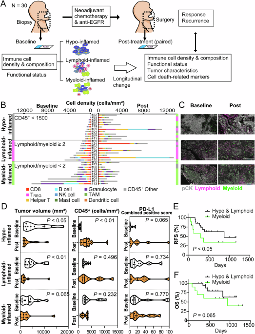 Neoadjuvant therapy-induced immune dynamics and myeloid-associated resistance in advanced head and neck cancer