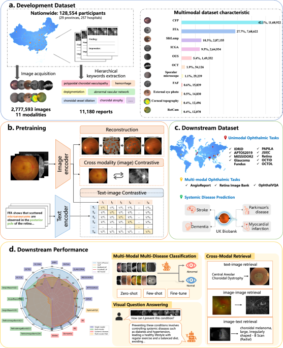 A multimodal visual–language foundation model for computational ophthalmology