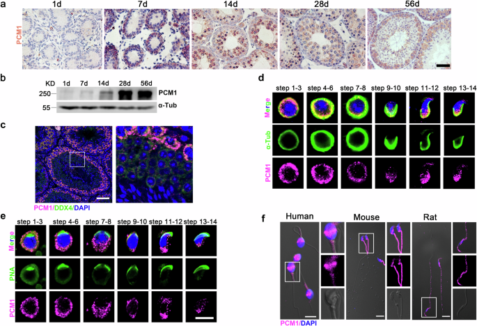 PCM1 orchestrates centrosomal and flagellar protein transport to promote sperm maturation