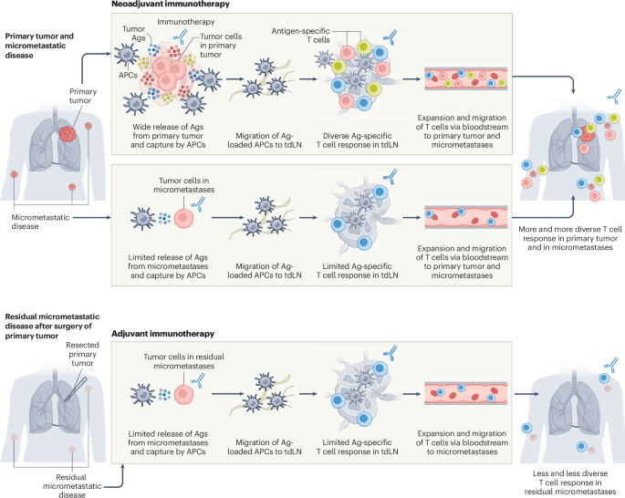 The rapidly evolving paradigm of neoadjuvant immunotherapy across cancer types