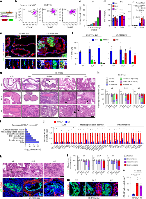 Innate immunity and the NF-κB pathway control prostate stem cell plasticity, reprogramming and tumor initiation