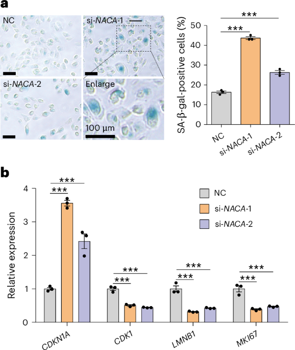 hUSI is a robust transcriptome-based cellular senescence prediction tool