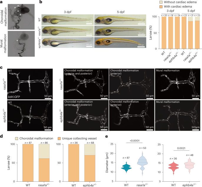 Reversal of cerebrovascular anomalies in a zebrafish model of vein of Galen aneurysm