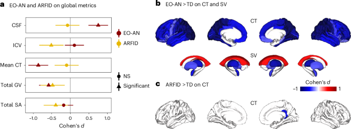 Neuroimaging insights into brain mechanisms of early-onset restrictive eating disorders
