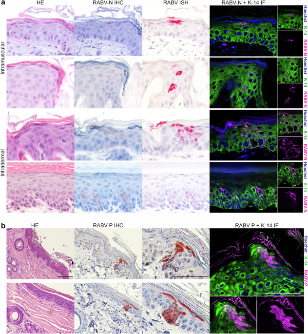 Exploring the role of infected keratinocytes during rabies virus infection