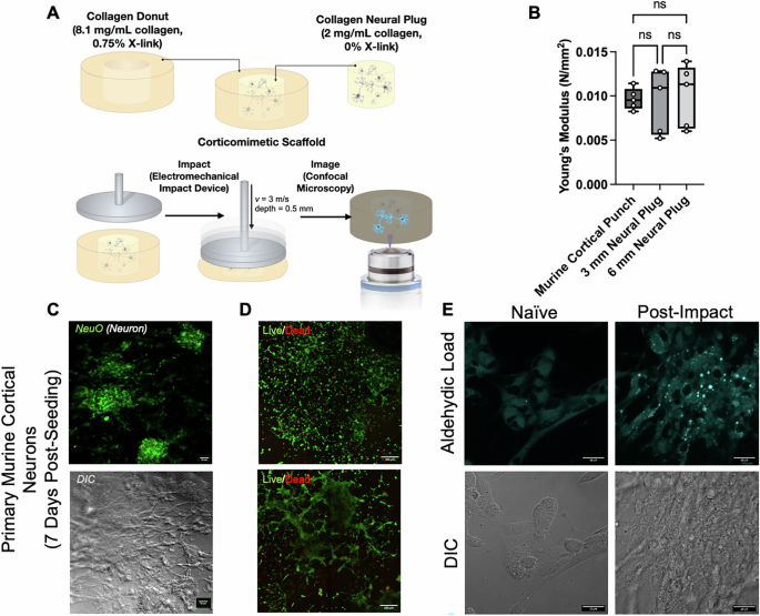 Aldehydic load as an objective imaging biomarker of mild traumatic brain injury