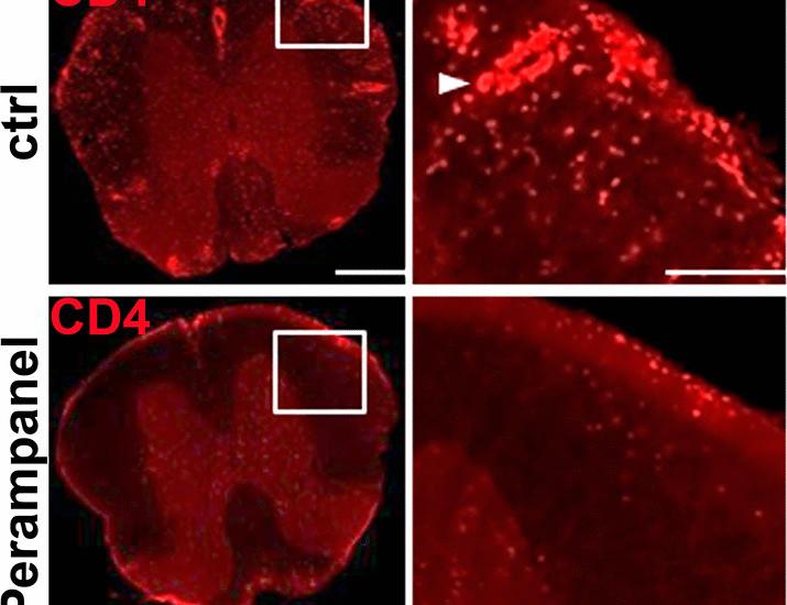 AMPAR inhibition lowers S1P in human blood and improves murine autoimmune neuroinflammation by blocking T cell egress from lymph nodes | Science Translational Medicine