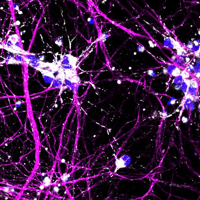 CRISPR Reveals Mitochondrial Dysfunction Underlying ALS
