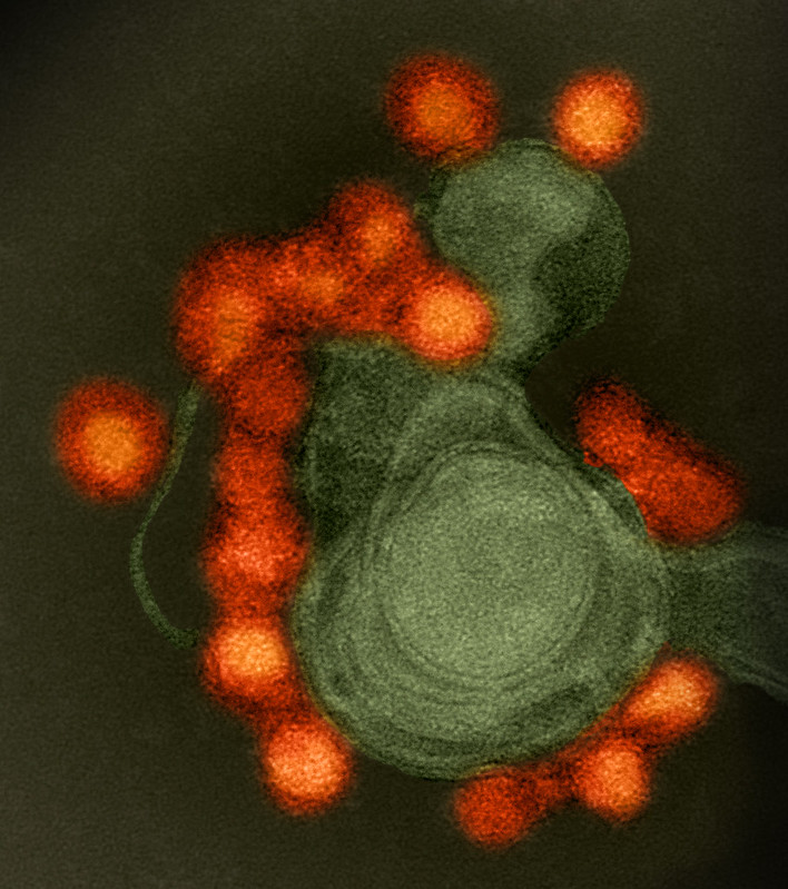 How Zika Uses a Crucial Host Cell Process to Its Advantage
