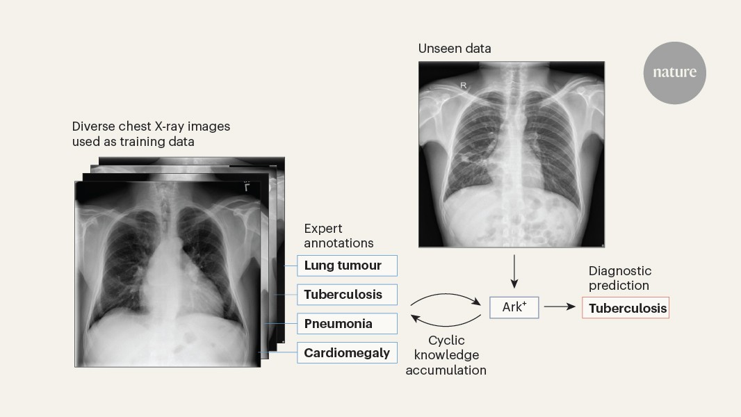 An open AI model could help medical experts to interpret chest X-rays