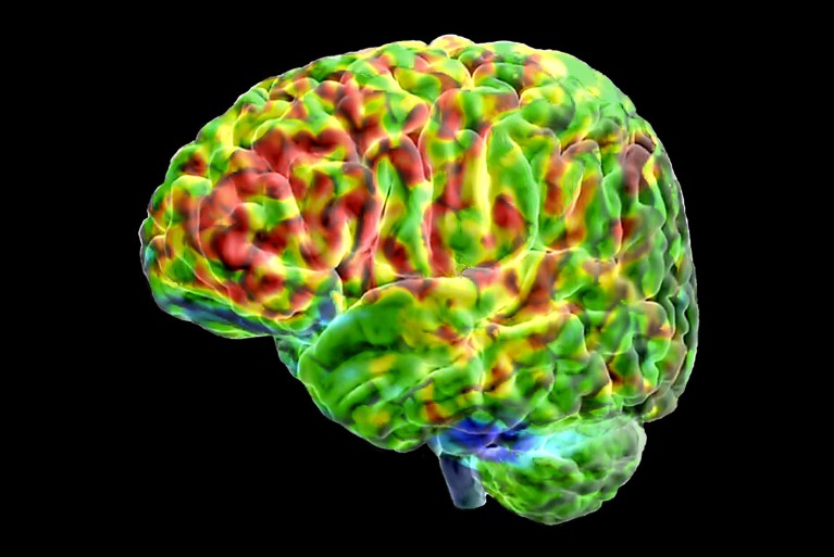 How the brain separates real images from those it imagines