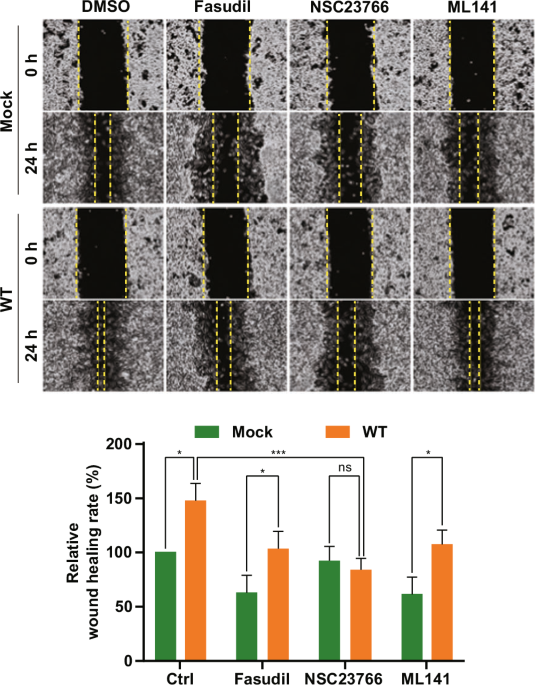 Author Correction: SAMHD1-induced endosomal FAK signaling promotes human renal clear cell carcinoma metastasis by activating Rac1-mediated lamellipodia protrusion