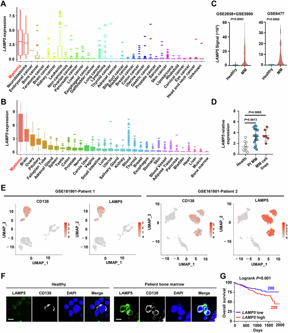 LAMP5 modulates IRF4 stability and nuclear transport: a critical mechanism in myeloma progression and therapy