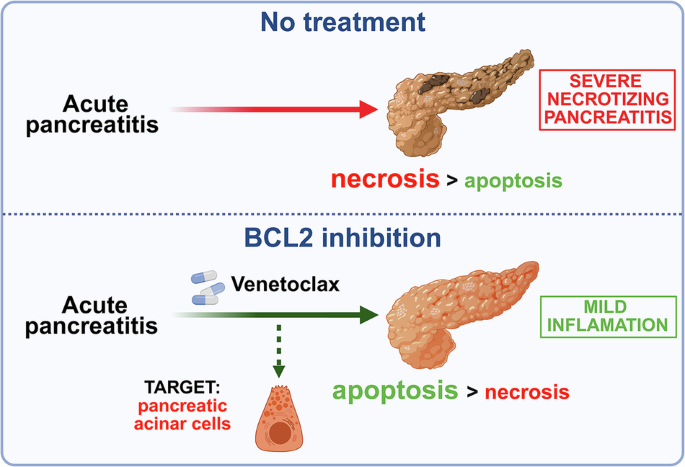 Repurposing BCL2 inhibitors: Venetoclax protects against acinar cell necrosis in acute pancreatitis by promoting apoptosis