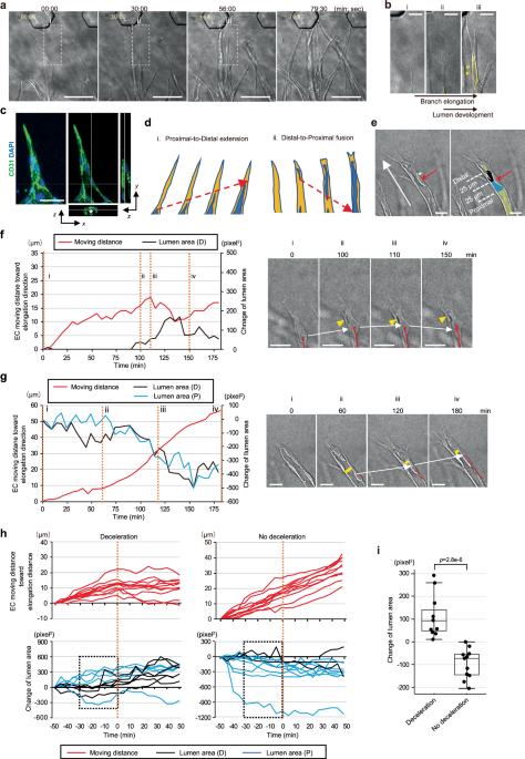Biomechanical control of vascular morphogenesis by the surrounding stiffness