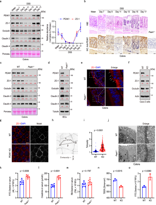 PEAK1 maintains tight junctions in intestinal epithelial cells and resists colitis by inhibiting autophagy-mediated ZO-1 degradation