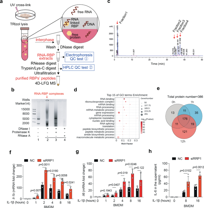 The RNA-binding protein RRP1 brakes macrophage one-carbon metabolism to suppress autoinflammation