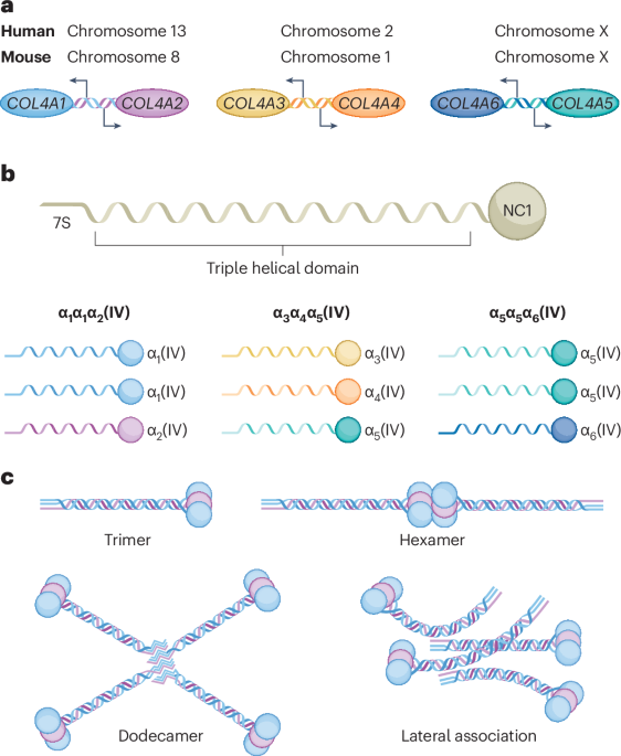 Collagen IV in Gould syndrome and Alport syndrome