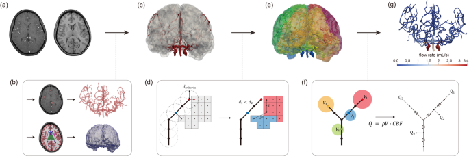 Physiologic model of the cerebrovascular system using supply and demand between arteries and tissues