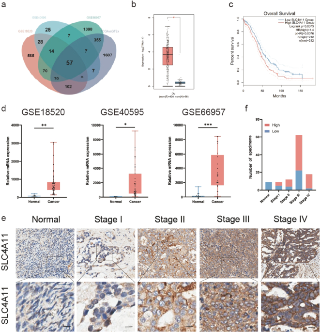 Elevated SLC4A11 expression promotes OV progression via interaction with EGFR