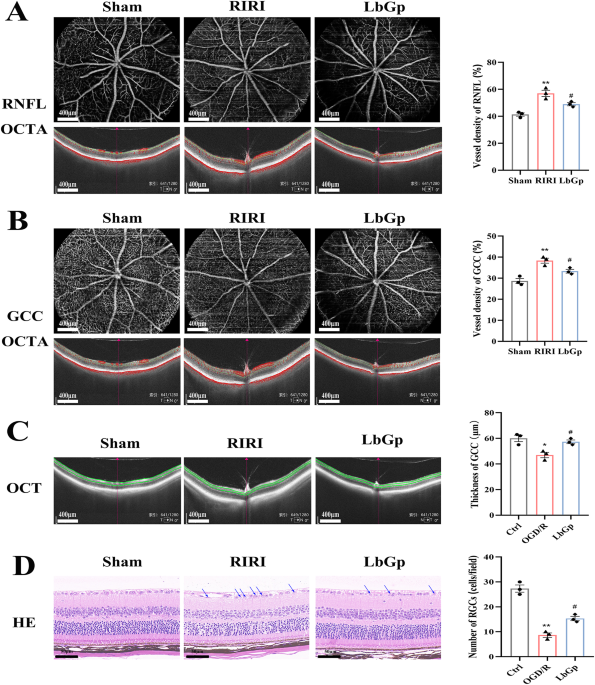 Lycium barbarum glycopeptide mitigates retinal ischemia-reperfusion injury through its anti-inflammatory, anti- senescence, and anti-apoptosis properties