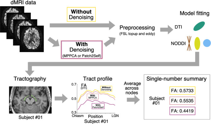 Evaluating the impact of denoising diffusion MRI data on tractometry metrics of optic tract abnormalities in glaucoma