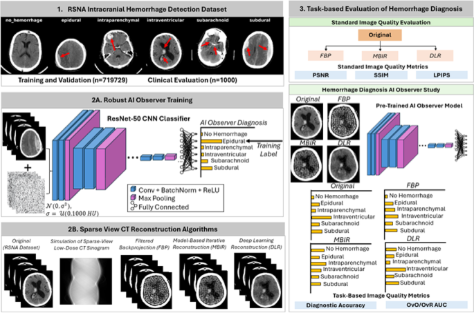 Task based evaluation of sparse view CT reconstruction techniques for intracranial hemorrhage diagnosis using an AI observer model