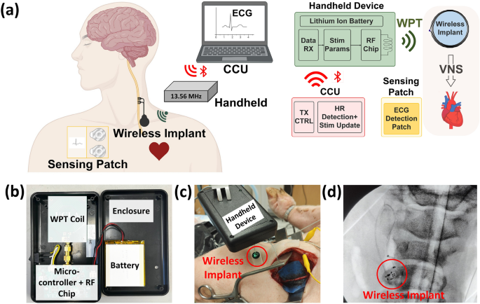 A closed loop fully automated wireless vagus nerve stimulation system