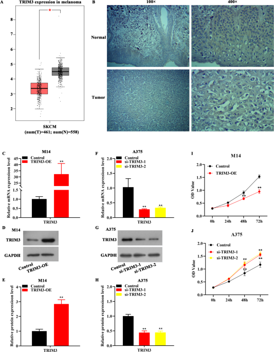 TRIM3 suppressed the tumorigenicity of melanoma cells by ubiquitinating YAP1