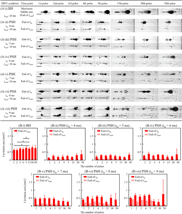 A parametric study of bubble dynamics and lesion formation in liver tissue phantom during pressure-modulated shockwave histotripsy