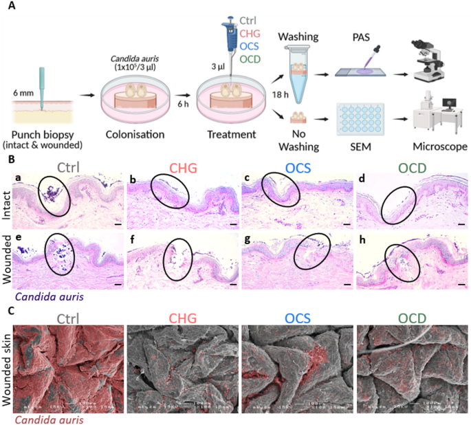 Octenidine effectively reduces Candida auris colonisation on human skin