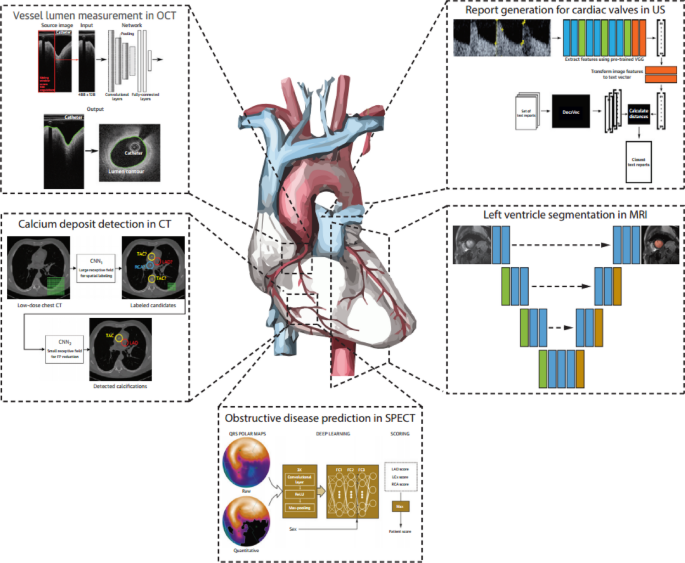 Enhancing cardiac disease detection via a fusion of machine learning and medical imaging