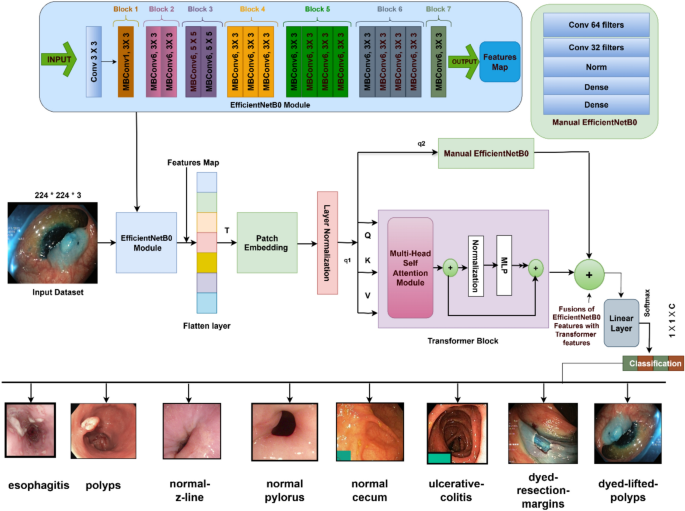 Hybrid deep learning framework based on EfficientViT for classification of gastrointestinal diseases