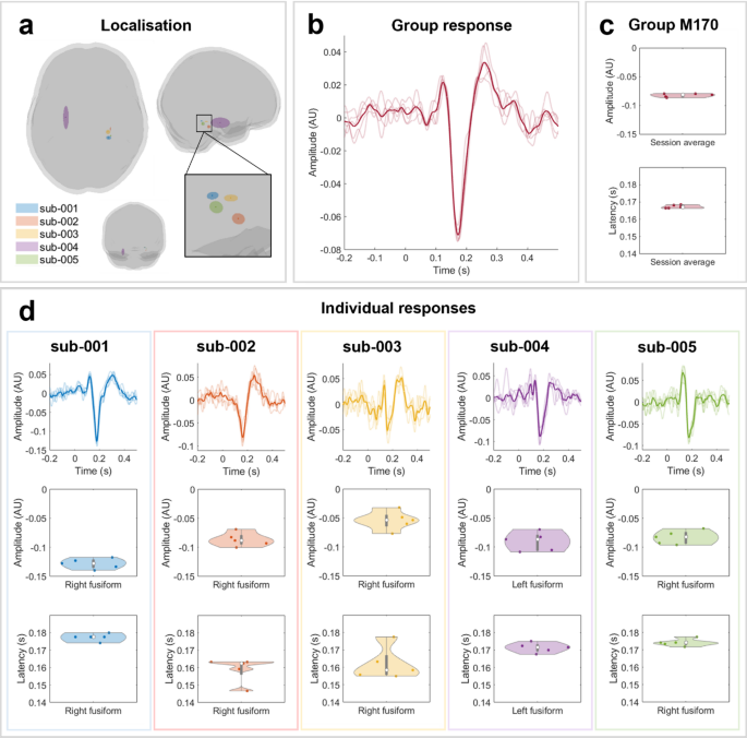 Assessing the stability of evoked, induced, and passive MEG responses for repeat testing with optically pumped magnetometers