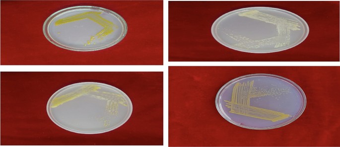Interpretable multitask deep learning model for detecting and analyzing severity of rice bacterial leaf blight
