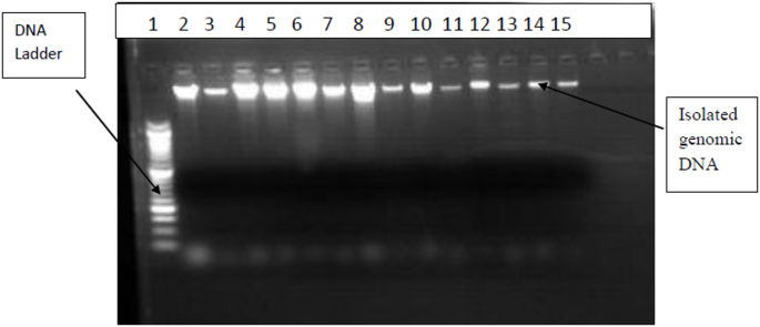Association between vitamin D receptor FokI gene polymorphism and risk of type 2 diabetes mellitus in the Ethiopian population