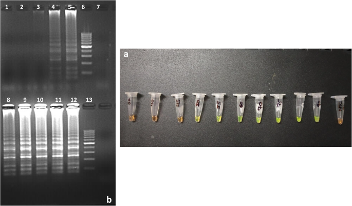 Polymerase spiral reaction assay for rapid visual detection of Mycobacterium avium subsp. paratuberculosis in fecal samples