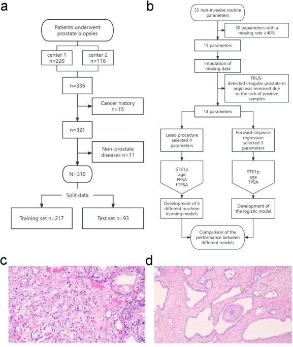 A visualized machine learning model using noninvasive parameters to differentiate men with and without prostatic carcinoma before biopsy