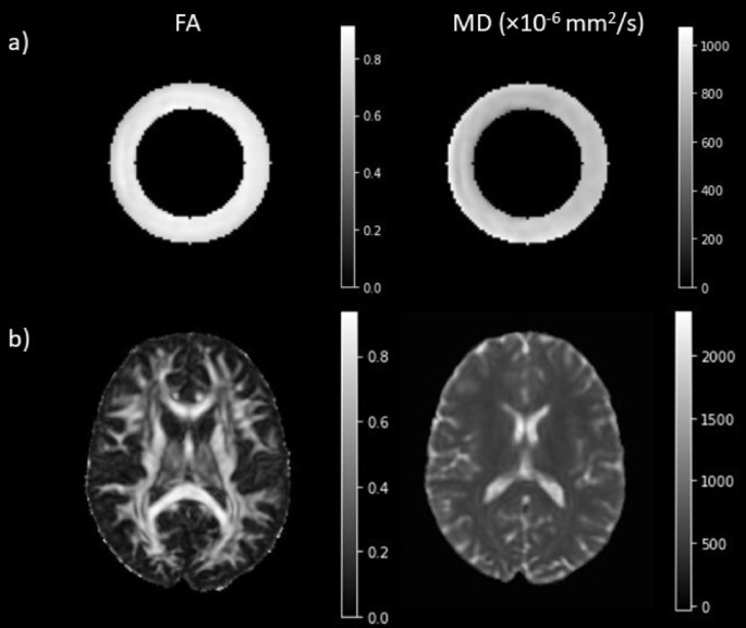 Assessment of a diffusion phantom for quality assurance in brain microstructure diffusion MRI studies