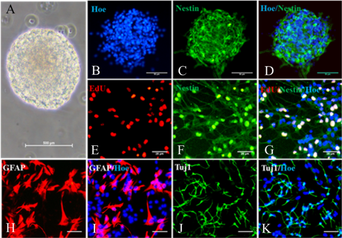 Curcumin exerts neuroprotective effects on proliferation of neural stem cells in vitro and APP/PS1 mouse model in vivo