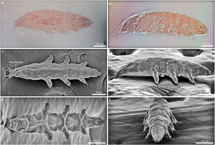 Greenlandic water bears reveal a new morphological trait of external head sensory organs