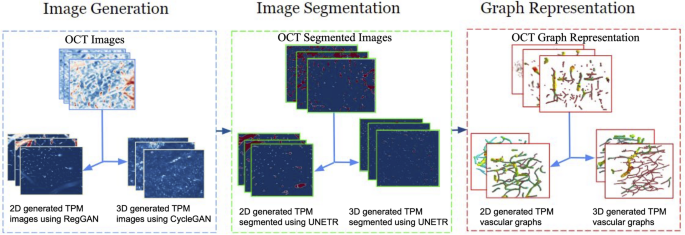 Improving microvascular brain analysis with adversarial learning for OCT–TPM vascular domain translation